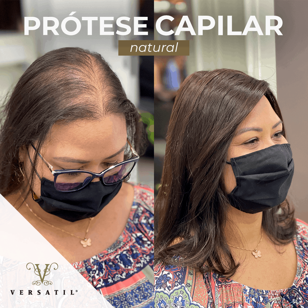Prótese Capilar Feminina