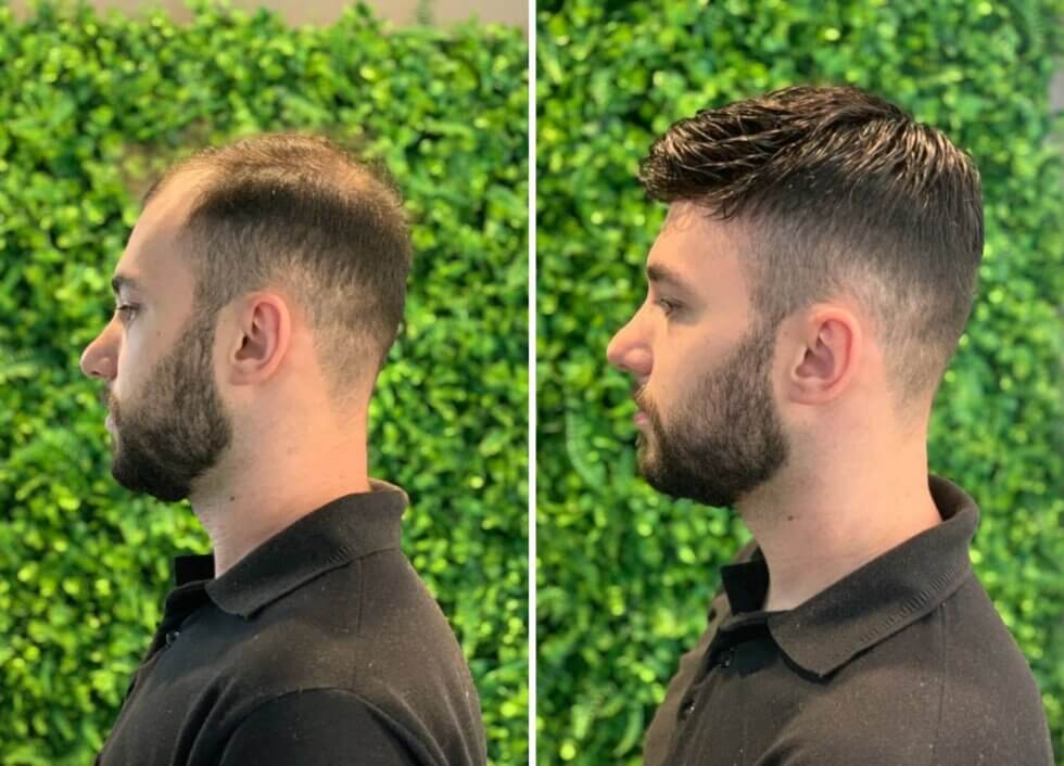 Prótese Capilar - Versátil Mega Hair